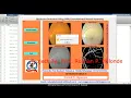 Glaucoma Detection Using Machine Learning CNN Glaucoma Prediction Using Matlab Project Code