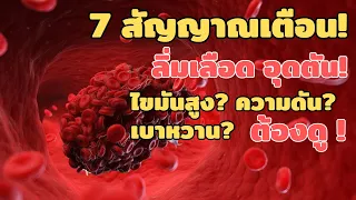 สัญญาณเตือนลิ่มเลือดในสมองที่ควรจำไว้คืออะไร