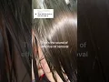 Download Lagu Lice removal asmr
