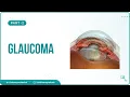 9 Glaucoma Visual Field Defects Optic Disk Changes management Secondary Glaucoma Part - 2