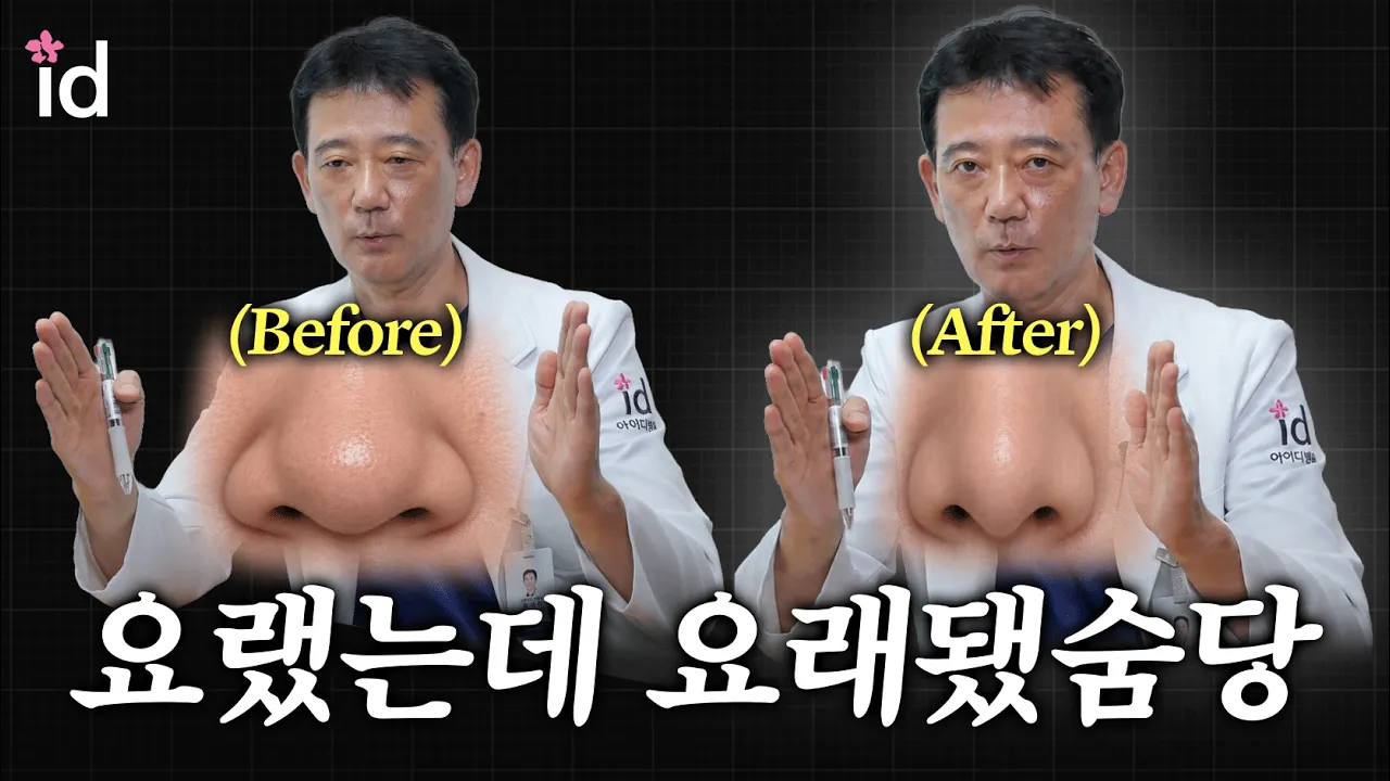 복코 수술, 코 평수만 줄이면 끝일까?