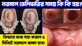 নরমাল ডেলিভারির সময় কি কি হয়? || কিভাবে ব্যথা সহ্য করলে ৫ মিনিটে নরমালে বাচ্চা হবে! | নরমাল ডেলিভারি