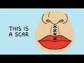 Why There s A Groove Above Your Lip