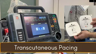 Crash Cart 04 Transcutaneous Pacing TCP