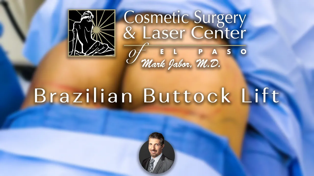 Brazilian Buttock Lift - Cosmetic Surgery and Laser Center of El Paso | Dr. Mark Jabor