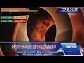 Download Lagu SUNEVO DAILY NEWS - SUN SPOT EXPLOSION ON THE SUN!