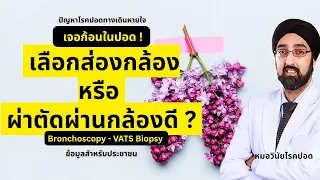 เมื่อไหร่ที่แพทย์จะแนะนำให้ผ่าตัดปอดแทนการส่องกล้องตัดชิ้นเนื้อ