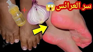 سر جمال القدمين عروس أو متزوجة ودعي إسمرار و تشققات القدمين للأبد تقشير-تنعيم وتبييض بياض الثلج