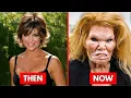 25 Famous Celebrities Who Ruined Their Faces with Plastic Surgery Before After 2026