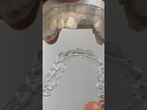 Another Essix appliance for Dr. Joseph Rigg