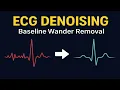 ECG Signal Denoising in Python Baseline Wander Removal with Wavelets