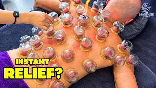 Fire Cupping in Vietnam ASMR