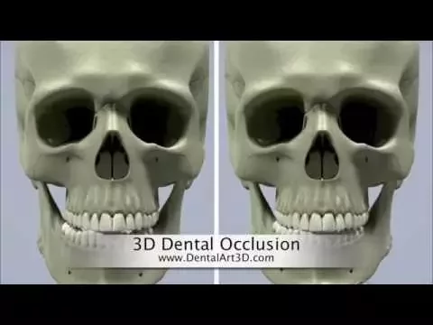 Download MP3 DentalArt3D. 3D Dental Occlusion