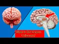 What is the Corpus Callosum