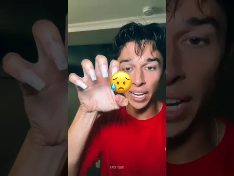 What Happens When You Bite Your Nails Every Day? 😱💅