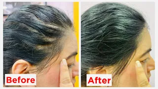 #AD  Get rid of hair loss at home with L'Oreal Paris Fall Resist Serum | JSuper Kaur