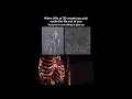 Download Lagu When UVs of 3D model you pick sucks the life out of you