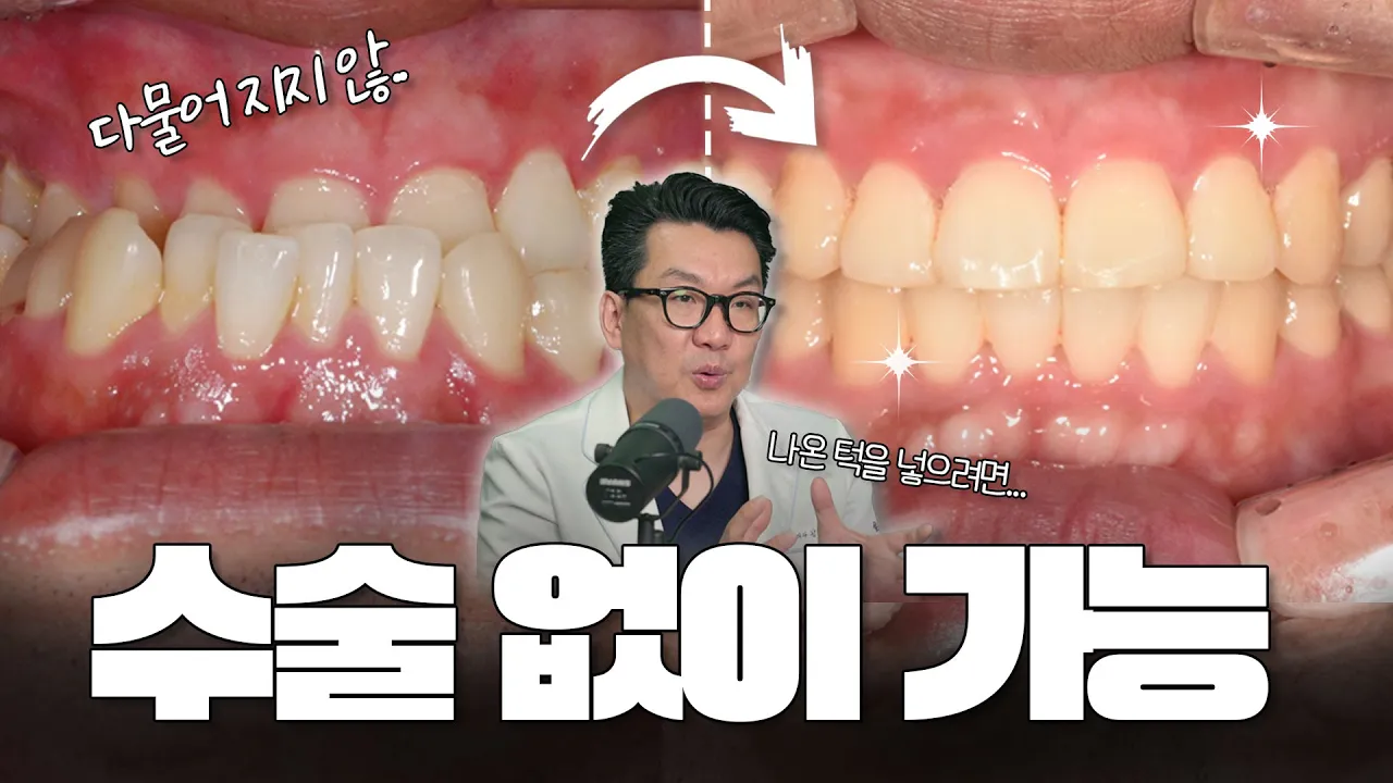 주걱턱, 수술보다 교정으로 치료해야 하는 이유