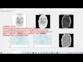 Fingerprint reconstruction MATLAB tutorial Fingerprint enhancement Matlab