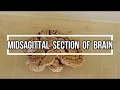 Midsagittal Section of Brain neuroanatomy