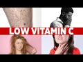 8 Signs of a Vitamin C Deficiency You ve Never Heard About