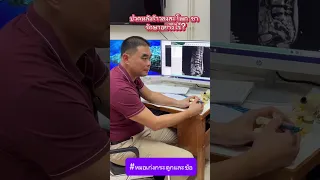  อาการปวดหลังร้าวลงขาเกิดจากสาเหตุอะไรบ้าง 