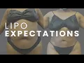 Setting expectations for your SONOBELLO experience Dr Nathan Miller