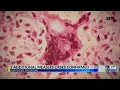 6 News at Noon The Headlines - August 13 2026