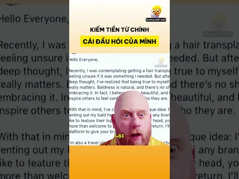 Kiếm tiền từ chính cái đầu hói của mình