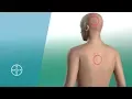 How Aspirin Works Bayer