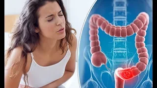 ئەگەر ئەم نیشانانەت هەبوو دەستبەجێ پشکنینی کۆڵۆن ئەنجام بدە 