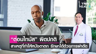 การผ่าตัดต่อมไทมัสแบบส่องกล้องมีข้อดีอย่างไรเมื่อเทียบกับการผ่าตัดแบบเปิด