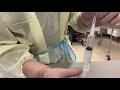Neutral Pressure Technique
