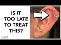 - When Is It Too LATE to Treat Piercing Bumps