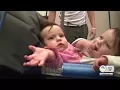 State agency designs solution to help conjoined twins walk