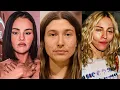 Celebrities Who Permanently RUINED Their Faces For Attention
