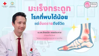 มะเร็งกระดูกเกิดจากสาเหตุอะไรบ้าง