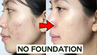 how to cover acne u0026 blemishes without foundation easy u0026 non cakey