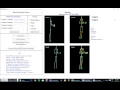 Kinect Server Application - Skeleton example