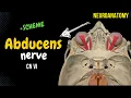 CN 6 Abducens Nerve Scheme Pathway Clinical Relevance Neuroanatomy