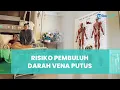 Download Lagu Kaki Suami Inul Daratista Alami Pendarahan akibat Batu Karang, Waspadai Risiko Pembuluh Vena Putus