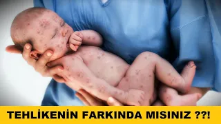 Aşı Karşıtlığı Felakete Sebep Olabilir!!! YouTube video detay ve istatistikleri