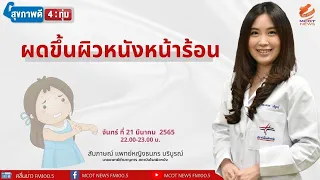 ทำไมการทาแป้งหรือครีมบางชนิดถึงไม่แนะนำสำหรับคนเป็นผดหน้าร้อน