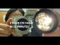 First Person Ophthalmologist Eye Exam Cataract Evaluation