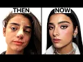Dixie D Amelio s Nose Job Surgeon Reacts