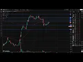 OTLK Stock Outlook Therapeutics stock analysis OTLK STOCK PREDICTION analysis news today