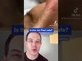 Crazy way to remove blackheads Jet Peel Demo 208SkinDoc