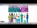 Updated TB Testing and Treatment Recommendations for Health Care Personnel