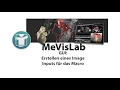 MeVisLab Macro TumorSeg Image Input