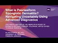 What is Psoriasiform Spongiotic Dermatitis Navigating Uncertainty Using Advanced Diagnostics